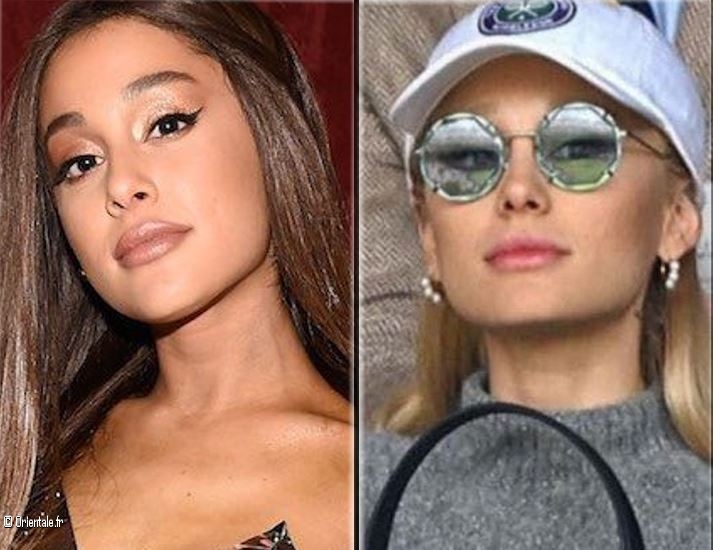 Ariana Grande Avant-Aprs les injections